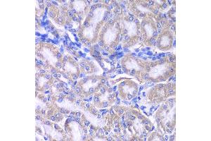 Immunohistochemistry of paraffin-embedded rat kidney using RMDN3 antibody at dilution of 1:200 (400x lens). (RMDN3 抗体)