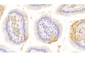 Immunohistochemistry (IHC) image for anti-Laminin, beta 1 (LAMB1) (AA 1053-1258) antibody (ABIN7439090)