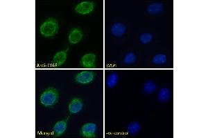 ABIN570878 Immunofluorescence analysis of paraformaldehyde fixed L929 cells (Mouse fibroblast cell line), permeabilized with 0. (LY6E 抗体  (Internal Region))