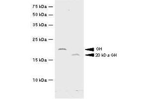 Recombinant hGH and 20kDa hGH were resolved by electrophoresis, transferred to PVDF membrane and probed with anti-hGH(1:500). (Growth Hormone 1 抗体  (AA 27-217))