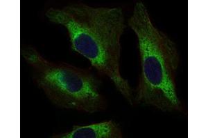 Immunocytochemistry (ICC) image for anti-Signal Transducer and Activator of Transcription 5A (STAT5A) (AA 583-794) antibody (ABIN1845625) (STAT5A 抗体  (AA 583-794))