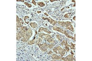 IHC analysis of RET using anti-RET antibody (ABIN6719502). (Ret Proto-Oncogene 抗体  (AA 29-304))