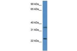 Image no. 1 for anti-Cytochrome B5 Reductase 1 (CYB5R1) (AA 93-142) antibody (ABIN6747224) (CYB5R1 抗体  (AA 93-142))