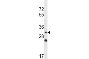 Western Blotting (WB) image for anti-Wingless-Type MMTV Integration Site Family, Member 3A (WNT3A) (AA 151-180) antibody (ABIN3029629)