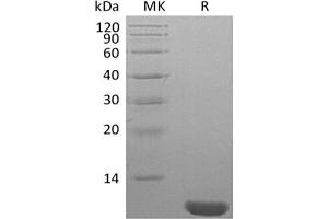 Western Blotting (WB) image for Neural Precursor Cell Expressed, Developmentally Down-Regulated 8 (NEDD8) protein (ABIN7319921) (NEDD8 蛋白)
