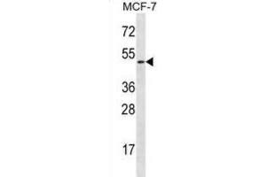 Western Blotting (WB) image for anti-Ladinin 1 (LAD1) antibody (ABIN2996996) (Ladinin 1 抗体)