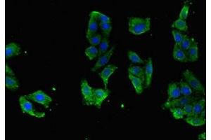 Immunofluorescent analysis of HepG2 cells using ABIN7167163 at dilution of 1:100 and Alexa Fluor 488-congugated AffiniPure Goat Anti-Rabbit IgG(H+L) (RASGRP1 抗体  (AA 594-716))