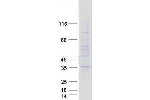 Validation with Western Blot