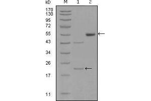 Western blot analysis using EPHA5 mouse mAb against truncated EPHA5-His recombinant protein (1) and truncated EPHA5(aa620-774)-hIgGFc transfected CHO-K1 cell lysate(2). (EPH Receptor A5 抗体  (AA 620-774))