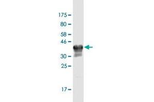 Western Blot detection against Immunogen (34. (Copine III 抗体  (AA 164-244))