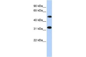WB Suggested Anti-C6orf150 Antibody Titration: 0. (C6orf150 抗体  (Middle Region))