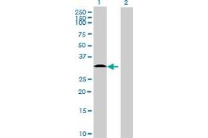 Western Blot analysis of TMEM40 expression in transfected 293T cell line ( H00055287-T01 ) by TMEM40 MaxPab polyclonal antibody. (TMEM40 抗体  (AA 1-203))