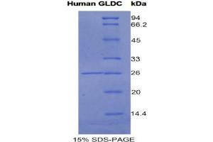 SDS-PAGE analysis of Human Glycine Dehydrogenase Protein. (GLDC 蛋白)