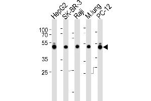 Western blot analysis of lysates from HepG2, SK-BR-3, Raji cell line, mouse lung tissue lysate and rat PC-12 cell line (from left to right), using DNAJA1 Antibody (C-term) (ABIN6242850 and ABIN6577522). (DNAJA1 抗体  (C-Term))