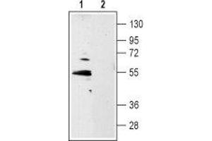 Western blot analysis of rat hippocampus lysate: - 1. (5HT1B Receptor 抗体  (Extracellular, N-Term))