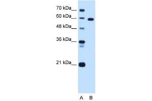 Western Blot showing TBX15 antibody used at a concentration of 1. (T-Box 15 抗体  (C-Term))