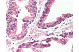 Anti-GPR126 antibody IHC of human prostate. (G Protein-Coupled Receptor 126 抗体  (N-Term))