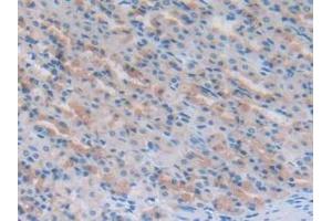Detection of NT-ProANP in Rat Stomach Tissue using Polyclonal Antibody to N-Terminal Pro-Atrial Natriuretic Peptide (NT-ProANP) (PRO-ANP 抗体  (AA 25-122))