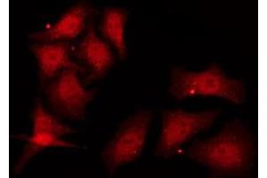 ABIN6278388 staining COS7 by IF/ICC. (TSG101 抗体)