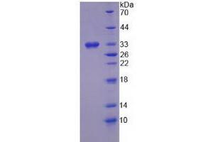SDS-PAGE (SDS) image for Hydroxysteroid (17-Beta) Dehydrogenase 3 (HSD17B3) (AA 1-310) protein (His tag) (ABIN6237084)