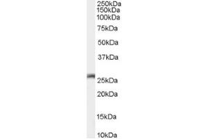 Image no. 1 for anti-Gap Junction Protein, beta 2, 26kDa (GJB2) (C-Term) antibody (ABIN374836) (GJB2 抗体  (C-Term))