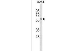 Rab9p40 Antibody (C-term) (ABIN1537097 and ABIN2838354) western blot analysis in  cell line lysates (35 μg/lane). (RABEPK 抗体  (C-Term))