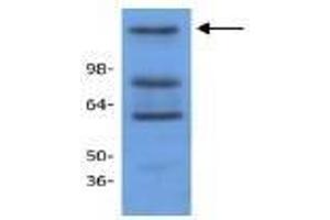 Image no. 1 for anti-Histone Deacetylase 9 (HDAC9) antibody (ABIN127248) (HDAC9 抗体)