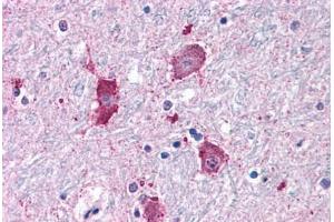 Anti-NPY5R antibody  ABIN1049126 IHC staining of human brain, neurons and glia. (NPY5R 抗体  (Cytoplasmic Domain))