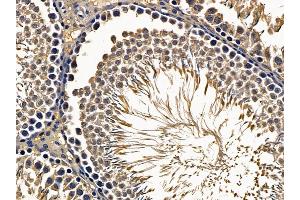 anti-Laminin, beta 2 (Laminin S) (LAMB2) (N-Term) antibody