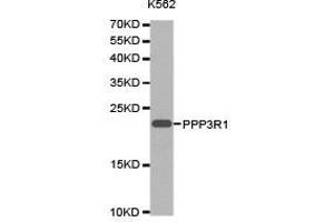 Western Blotting (WB) image for anti-Protein Phosphatase 3, Regulatory Subunit B, alpha (PPP3R1) antibody (ABIN1874237) (PPP3R1 抗体)