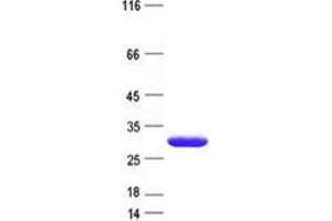 Western Blotting (WB) image for Sulfotransferase Family, Cytosolic, 6B, Member 1 (SULT6B1) protein (His tag) (ABIN5505777)