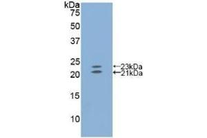Detection of Recombinant EDN1, Mouse using Polyclonal Antibody to Endothelin 1 (EDN1) (Endothelin 1 抗体  (AA 33-202))