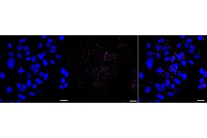 Immunocytochemical staining of HepG2 cells with Interferon beta 1 antibody (ABIN7799092), 1:1,000).