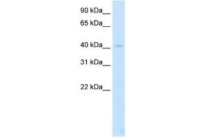 WB Suggested Anti-LDB2 Antibody Titration:  2. (LIM Domain Binding 2 Protein 抗体  (N-Term))