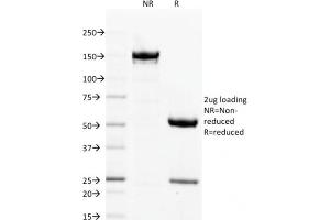 SDS-PAGE Analysis Purified Filaggrin Mouse Monoclonal Antibody (FLG/1563). (Filaggrin 抗体  (AA 998-1104))