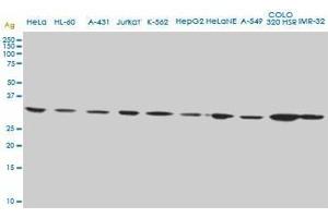 CD5L monoclonal antibody (M01), clone 1C8. (CD5L 抗体  (AA 41-140))