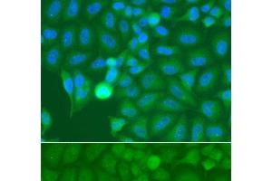 Immunofluorescence analysis of A549 cells using IRAK2 Polyclonal Antibody (IRAK2 抗体)