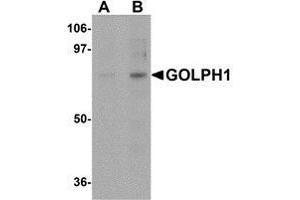 Western blot analysis of GOLPH1 in K562 cell lysate with AP30370PU-N GOLPH1 antibody at (A) 1 and (B) 2 μg/ml.