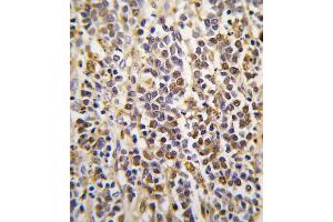Formalin-fixed and paraffin-embedded human kidney tissue reacted with ALDH1A3 Antibody (Center), which was peroxidase-conjugated to the secondary antibody, followed by DAB staining. (ALDH1A3 抗体  (AA 318-348))