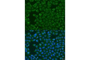 Immunofluorescence analysis of U2OS cells using FMO5 antibody (ABIN6133516, ABIN6140714, ABIN6140715 and ABIN6223596) at dilution of 1:100. (FMO5 抗体  (AA 1-285))