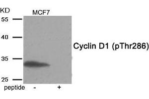 Western blot analysis of extracts from MCF7 tissue using Cyclin D1 (Phospho-Thr286) antibody. (Cyclin D1 抗体  (pThr286))