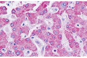 Immunohistochemistry (IHC) image for anti-Cytochrome P450, Family 21, Subfamily A, Polypeptide 2 (CYP21A2) (AA 151-200) antibody (ABIN2879259)