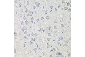 Immunohistochemistry of paraffin-embedded mouse brain using CD97 antibody (ABIN5971965) at dilution of 1/100 (40x lens). (CD97 抗体)