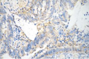 anti-Integrin beta 1 (ITGB1) antibody