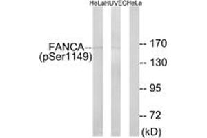 Western blot analysis of extracts from HeLa cells treated with IGF 100ng/ml 10' and HuvEc cells treated with EGF 200ng/ml 30', using FANCA (Phospho-Ser1149) Antibody. (FANCA 抗体  (pSer1149))
