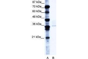 WB Suggested Anti-PCGF4 Antibody Titration:  0. (BMI1 抗体  (C-Term))