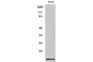 Western Blotting (WB) image for anti-Diazepam Binding Inhibitor (DBI) (Internal Region) antibody (ABIN3183140) (Diazepam Binding Inhibitor 抗体  (Internal Region))