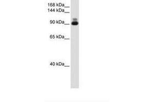 Image no. 2 for anti-Actinin, alpha 2 (ACTN2) (C-Term) antibody (ABIN204968) (ACTN2 抗体  (C-Term))