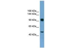 Image no. 1 for anti-Retinoblastoma Protein (Rb Protein) (N-Term) antibody (ABIN6745232) (Retinoblastoma Protein (Rb) 抗体  (N-Term))