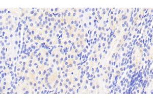 Detection of AFM in Human Kidney Tissue using Polyclonal Antibody to Afamin (AFM) (Afamin 抗体  (AA 22-210))